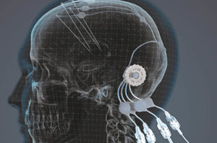 Engineering innovation brings hope for a Parkinson’s cure