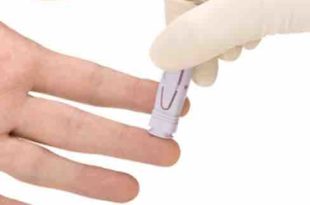 Covid-19 screening tests help employers prevent and manage outbreaks