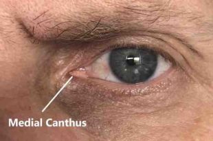 Thermal imaging camera for COVID-19 fever screening