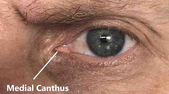 Thermal imaging camera for COVID-19 fever screening