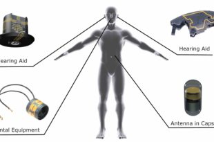 Minimised sensing high-tech within the patient